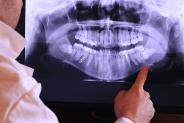 Best Chipped Tooth Repair Near Me  in Laurel Springs, NJ